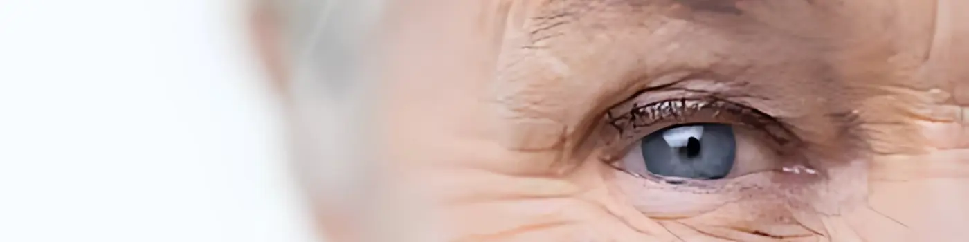 Glaucoma (Eye Pressure Disease)