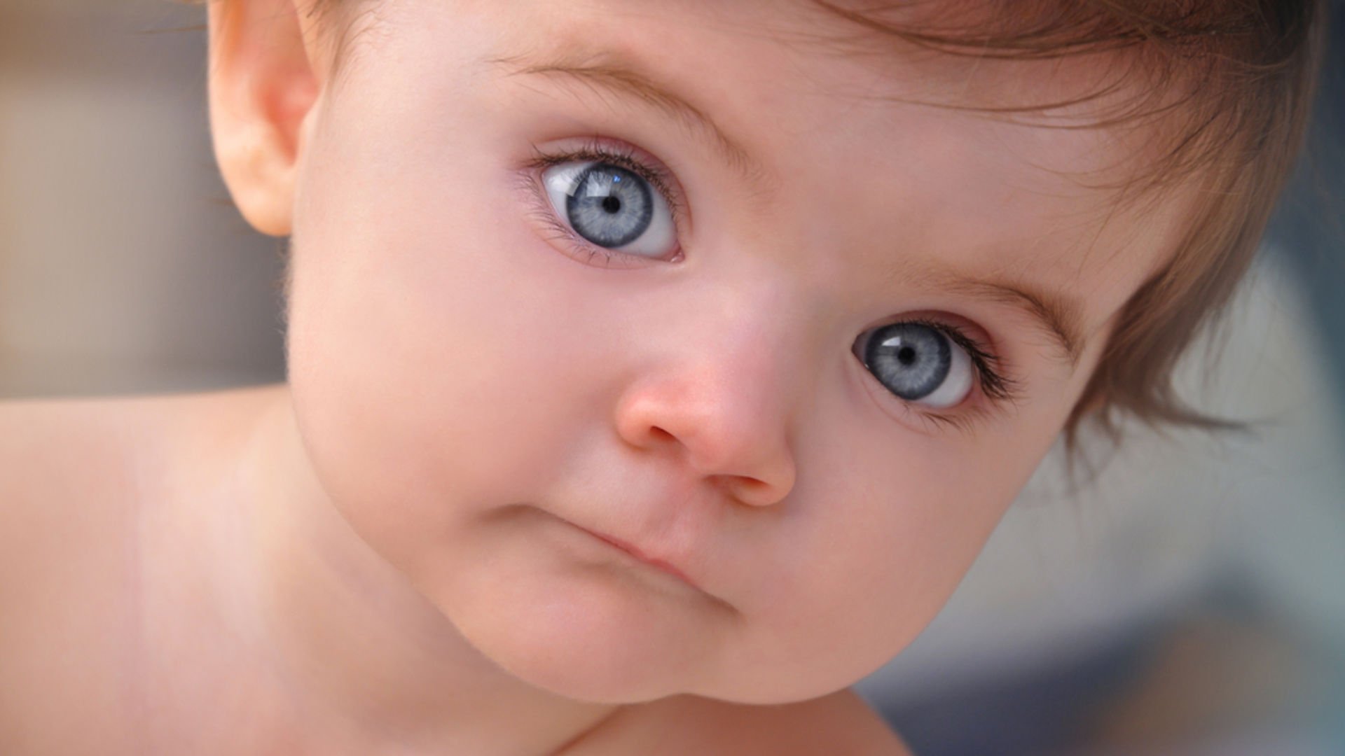 Congenital Glaucoma