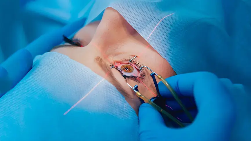 LASIK Surgery: The Most Effective Way to Get Rid of Glasses and Contact Lenses