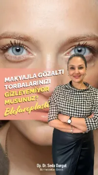 eskişehir badem göz estetiği