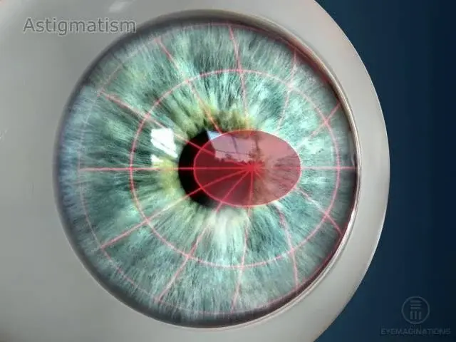 Toric Lens