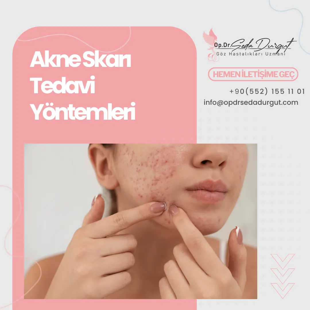 akne skarı nasıl geçer