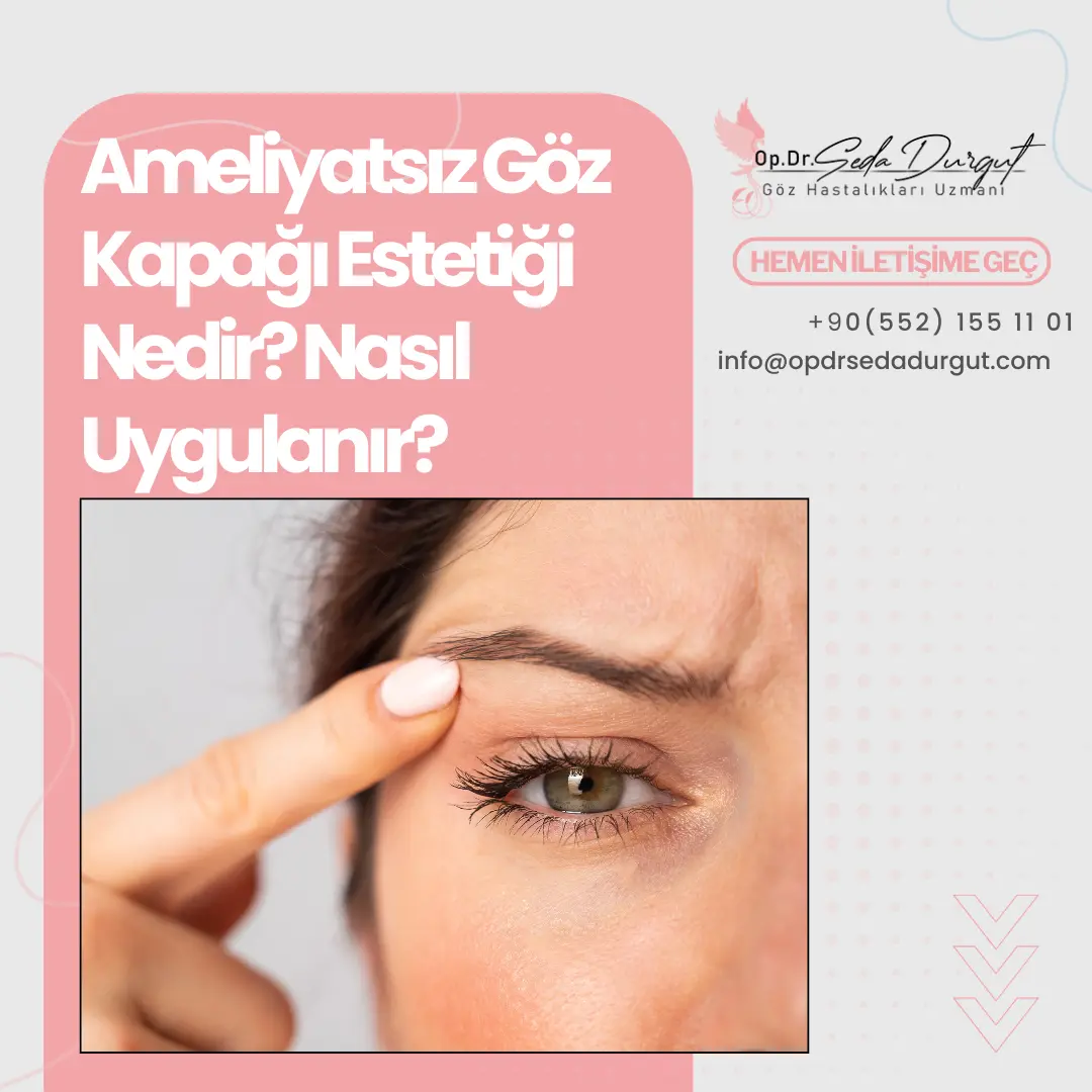 ameliyatsız göz kapağı estetiği