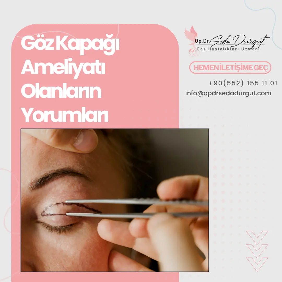 lazerle göz kapağı estetiği